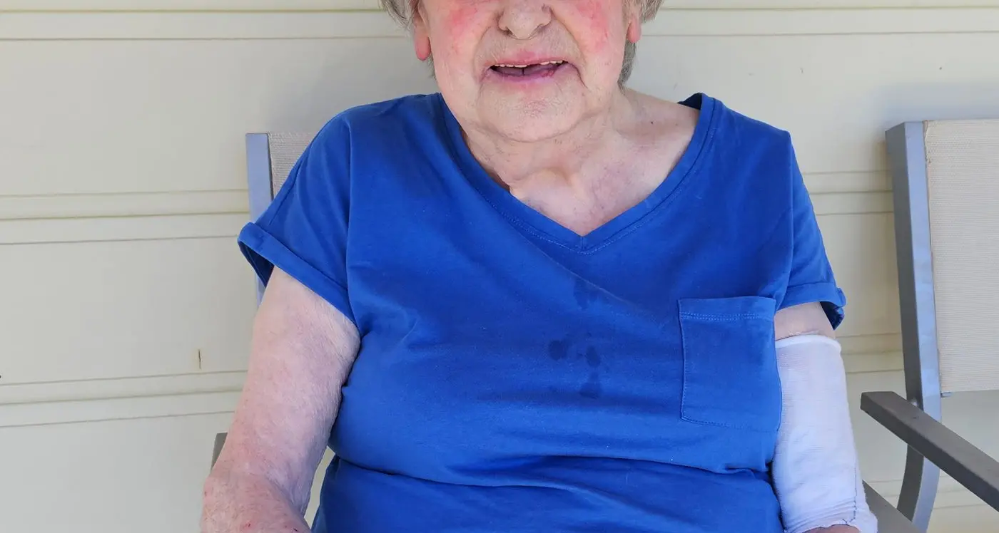 Margaret set to enjoy a wound-free Christmas